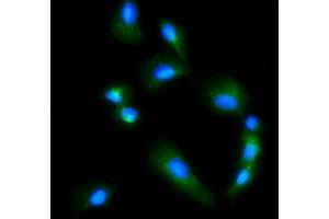 IF analysis of Glutaminase/GLS using anti-Glutaminase/GLS antibody (ABIN7601603).