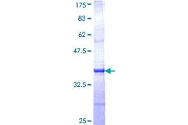 CTNS Protein (AA 1-100) (GST tag)