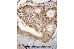 C11orf53 antibody (C-term) immunohistochemistry analysis in formalin fixed and paraffin embedded human pancreas tissue followed by peroxidase conjugation of the secondary antibody and DAB staining. (C11orf53 抗体  (C-Term))