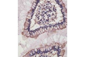 (ABIN6242485 and ABIN6578840) staining NRAS in human small intestine tissue sections by Immunohistochemistry (IHC-P - paraformaldehyde-fixed, paraffin-embedded sections). (GTPase NRas 抗体)