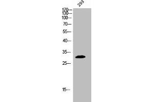 Western Blot analysis of 293 cells using Phospho-BAM32 (Y139) Polyclonal Antibody (DAPP1 抗体  (pTyr139))