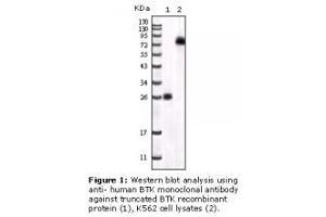 Image no. 2 for anti-Bruton Agammaglobulinemia tyrosine Kinase (BTK) antibody (ABIN232137) (BTK 抗体)