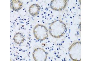 Immunohistochemistry of paraffin-embedded Human stomach using CABP7 Polyclonal Antibody at dilution of 1:100 (40x lens). (CABP7 抗体)