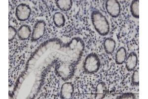 Image no. 1 for anti-Zinc Finger Protein 138 (ZNF138) (AA 151-251) antibody (ABIN599468) (ZNF138 抗体  (AA 151-251))