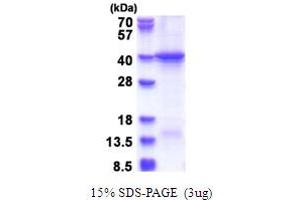 SDS-PAGE (SDS) image for Hect Domain and RLD 5 (HERC5) (AA 681-1024) protein (His tag) (ABIN5853692) (HERC5 Protein (AA 681-1024) (His tag))