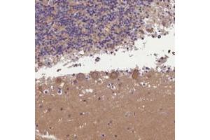 Immunohistochemical staining of human cerebellum with AP3B2 polyclonal antibody  shows moderate cytoplasmic positivity in Purkinje cells at 1:200-1:500 dilution.