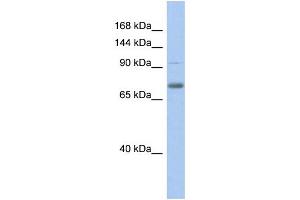 WB Suggested Anti-ZKSCAN5 Antibody Titration:  0.