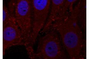 Immunofluorescence staining of methanol-fixed Hela cells, using Phospho-SNCA-Y133 antibody. (SNCA 抗体  (pTyr133))