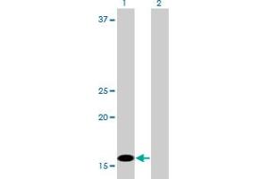Western Blotting (WB) image for anti-C1D Nuclear Receptor Corepressor (C1D) (AA 1-142) antibody (ABIN599137) (C1D 抗体  (AA 1-142))