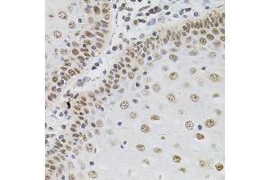 Immunohistochemistry of paraffin-embedded human esophagus using TGM2 antibody (ABIN5970369) (40x lens). (Transglutaminase 2 抗体)