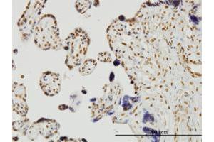 Immunoperoxidase of monoclonal antibody to RUNX2 on formalin-fixed paraffin-embedded human placenta. (RUNX2 抗体  (AA 251-350))