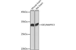 Western blot analysis of extracts of various cell lines, using EB3/M Rabbit mAb (ABIN7268535) at 1:1000 dilution. (MAPRE3 抗体)