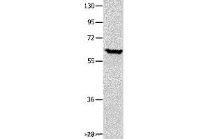 Western blot analysis of Human seminoma tissue, using DNAJC7 Polyclonal Antibody at dilution of 1:400 (DNAJC7 抗体)