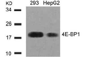 Image no. 3 for anti-Eukaryotic Translation Initiation Factor 4E Binding Protein 1 (EIF4EBP1) (AA 43-47) antibody (ABIN197452) (eIF4EBP1 抗体  (AA 43-47))