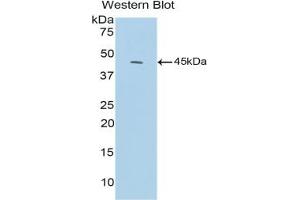 Detection of Recombinant C3a, Mouse using Polyclonal Antibody to Complement Component 3a (C3a) (C3a 抗体  (AA 671-748))