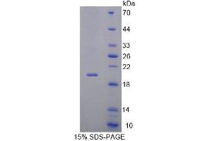 SDS-PAGE analysis of Mouse Interleukin 7 Receptor Protein. (IL7R 蛋白)