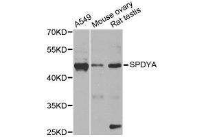 Western blot analysis of extracts of various cell lines, using SPDYA antibody. (SPDYA 抗体  (AA 1-313))