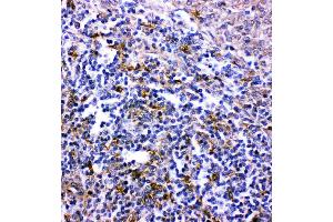 Anti- CXCR6 antibody, IHC(P): Rat Spleen Tissue