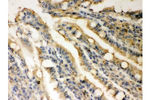 Immunohistochemistry (IHC) image for anti-DNA Repair Protein Homolog 1 (RAD51) (AA 1-258) antibody (ABIN3043560)