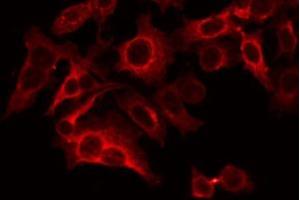 ABIN6266638 staining LOVO by IF/ICC. (Synaptophysin 抗体  (Internal Region))
