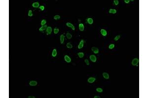Immunofluorescence staining of Hela cells with ABIN7139179 at 1:37. (HIST1H3A 抗体  (acLys36))