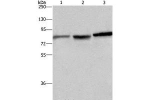Western Blot analysis of Mouse brain tissue, A172 and Hela cell using DBH Polyclonal Antibody at dilution of 1:200 (DBH 抗体)