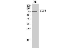 Western Blotting (WB) image for anti-CD93 (CD93) (Internal Region) antibody (ABIN3181439) (CD93 抗体  (Internal Region))