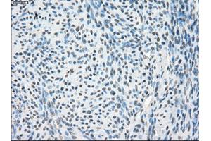 Immunohistochemical staining of paraffin-embedded Kidney tissue using anti-PPP5Cmouse monoclonal antibody. (PP5 抗体)