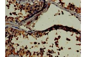 Immunohistochemistry of paraffin-embedded human testis tissue using ABIN7157798 at dilution of 1:100 (Lactate Dehydrogenase C 抗体  (AA 2-332))