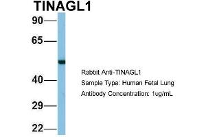 Western Blotting (WB) image for anti-Tubulointerstitial Nephritis Antigen-Like 1 (TINAGL1) (Middle Region) antibody (ABIN2787305)