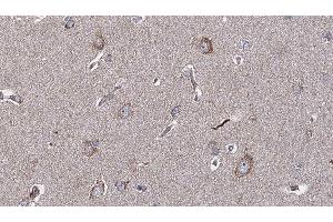 anti-Interleukin 10 Receptor, alpha (IL10RA) (C-Term) antibody