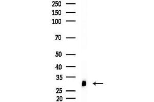 anti-Six Transmembrane Epithelial Antigen of The Prostate 1 (STEAP1) (N-Term) antibody