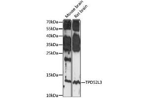 Western blot analysis of extracts of various cell lines, using TPD52L3 antibody (ABIN7271079) at 1:1000 dilution. (TPD52L3 抗体  (AA 1-132))