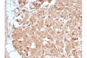 Formalin-fixed, paraffin-embedded human Pancreas stained with CELA3B Rabbit Recombinant Monoclonal Antibody (CELA3B/2809R). (Recombinant Elastase 3B 抗体  (AA 82-238))