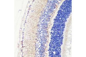 Immunohistochemistry of paraffin-embedded mouse retina using CRB1 antibody (ABIN7266524) at dilution of 1:200 (40x lens). (CRB1 抗体  (AA 20-200))