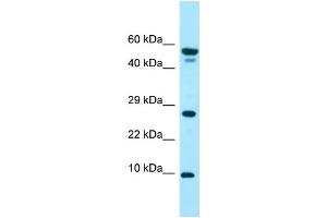 WB Suggested Anti-GGNBP1 Antibody Titration: 1. (GGNBP1 抗体  (N-Term))