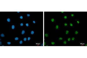 ICC/IF Image c-Myc antibody detects c-Myc protein at nucleus by immunofluorescent analysis. (c-MYC 抗体  (Center))