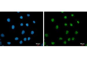 ICC/IF Image c-Myc antibody detects c-Myc protein at nucleus by immunofluorescent analysis.
