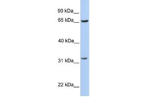 PBK antibody used at 1 ug/ml to detect target protein.