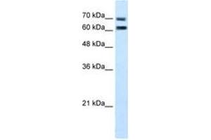 Image no. 2 for anti-Family with Sequence Similarity 55, Member D (FAM55D) (AA 407-456) antibody (ABIN205071) (FAM55D 抗体  (AA 407-456))