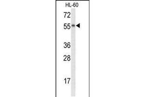Western blot analysis of NYX Antibody in HL-60 cell line lysates (35ug/lane) (Nyctalopin 抗体  (N-Term))