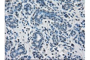 Immunohistochemical staining of paraffin-embedded breast tissue using anti-PPP5C mouse monoclonal antibody. (PP5 抗体)