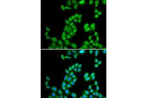 Immunofluorescence analysis of MCF-7 cell using RNASE13 antibody. (RNASE13 抗体  (AA 1-156))