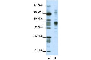 Western Blotting (WB) image for anti-Coronin, Actin Binding Protein, 1A (CORO1A) (C-Term) antibody (ABIN2780827)