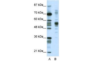 WB Suggested Anti-CORO1A  Antibody Titration: 1. (Coronin 1a 抗体  (C-Term))