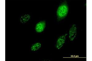 Immunofluorescence of purified MaxPab antibody to SCML1 on HeLa cell. (SCML1 抗体  (AA 1-208))