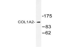 Western Blotting (WB) image for anti-Collagen, Type I, alpha 2 (COL1A2) (Chain alpha 2) antibody (ABIN498442)