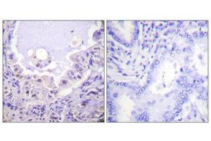 Immunohistochemistry (IHC) image for anti-V-Raf-1 Murine Leukemia Viral Oncogene Homolog 1 (RAF1) (Ser621) antibody (ABIN1847970) (RAF1 抗体  (Ser621))