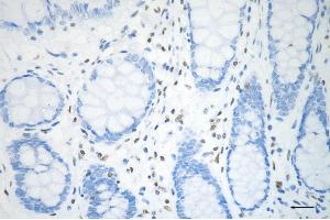 anti-H3 Histone, Family 3A (H3F3A) (H3S31ph) antibody