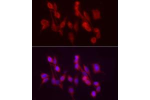 Immunofluorescence analysis of PC-12 cells using /GSNOR Rabbit pAb (ABIN6131172, ABIN6136579, ABIN6136580 and ABIN6217464) at dilution of 1:50 (40x lens). (ADH5 抗体  (AA 1-374))
